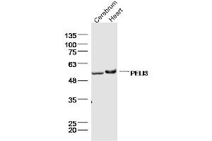 Lane 1: mouse cerebrum lysates Lane 2: mouse heart lysates probed with PELI3 Polyclonal Antibody, Unconjugated  at 1:300 dilution and 4˚C overnight incubation. (Pellino 3 抗体  (AA 301-400))