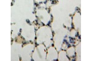 IHC-P analysis of Lung tissue, with DAB staining. (NUP88 抗体  (AA 159-422))