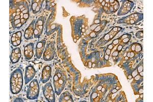 anti-RAB7, Member RAS Oncogene Family-Like 1 (RAB7L1) (pSer72) antibody