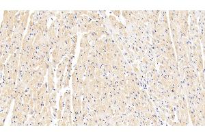 Immunohistochemistry (IHC) image for anti-Tensin 1 (TNS1) (AA 4-307) antibody (ABIN7444820)