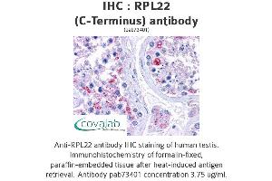 Image no. 2 for anti-Ribosomal Protein L22 (RPL22) (C-Term) antibody (ABIN1738940) (RPL22 抗体  (C-Term))
