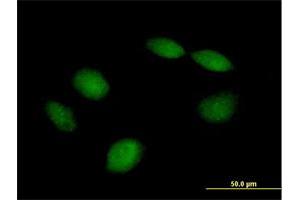 Immunofluorescence of purified MaxPab antibody to PHF21B on HeLa cell. (PHF21B 抗体  (AA 1-531))