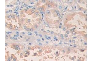 Immunohistochemistry (IHC) image for anti-Phospholipase A1 Member A (PLA1A) (AA 309-452) antibody (ABIN7437125)