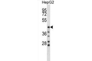 Western Blotting (WB) image for anti-Hyaluronidase-1 (HYAL1) antibody (ABIN2998320) (HYAL1 抗体)