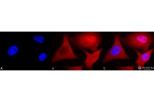 Immunocytochemistry/Immunofluorescence analysis using Mouse Anti-Ubiquitin Monoclonal Antibody, Clone 6C11-B3 . (Ubiquitin 抗体  (HRP))