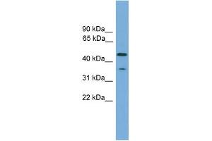 WB Suggested Anti-C6orf154 Antibody Titration: 0. (C6orf154 抗体  (N-Term))