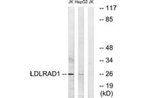 Western blot analysis of extracts from Jurkat/HepG2 cells, using LDLRAD1 Antibody. (LDLRAD1 抗体  (AA 84-133))