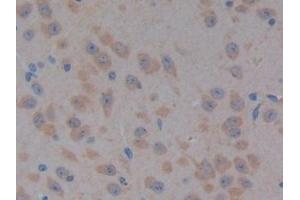 Immunohistochemistry (IHC) image for anti-Pyruvate Dehydrogenase Kinase, Isozyme 2 (PDK2) (AA 155-379) antibody (ABIN7439423)