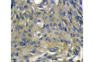 Immunohistochemistry (IHC) image for anti-C-Fos Induced Growth Factor (Vascular Endothelial Growth Factor D) (Figf) (AA 322-352) antibody (ABIN3030225)