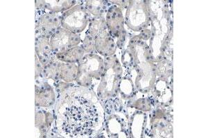Immunohistochemical staining of human kidney with C1orf210 polyclonal antibody  shows nucleolar positivity in renal tubules. (C1ORF210 抗体)
