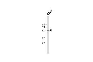 Anti-ARG Antibody (N-term) at 1:2000 dilution + Human liver lysate Lysates/proteins at 20 μg per lane. (PPARG 抗体  (N-Term))