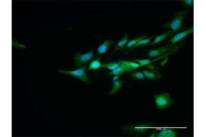 Immunofluorescence of purified MaxPab antibody to DCPS on HeLa cell. (DCPS 抗体  (AA 1-337))