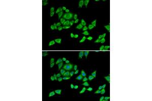 Immunofluorescence analysis of U2OS cells using OGDH antibody (ABIN6131413, ABIN6145002, ABIN6145004 and ABIN6216119). (alpha KGDHC 抗体  (AA 148-427))