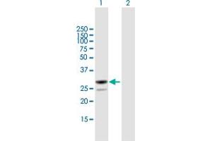 Western Blot analysis of MESDC2 expression in transfected 293T cell line by MESDC2 MaxPab polyclonal antibody. (MESDC2 抗体  (AA 1-234))