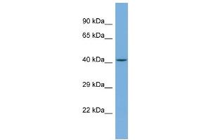 Host:  Rabbit  Target Name:  TRIM49C  Sample Type:  Jurkat Whole cell lysates  Antibody Dilution:  1. (TRIM49C 抗体  (N-Term))