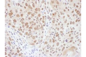 Immunohistochemistry (IHC) image for anti-Ring Finger Protein 20 (RNF20) (AA 125-175) antibody (ABIN7454669) (RNF20 抗体  (AA 125-175))
