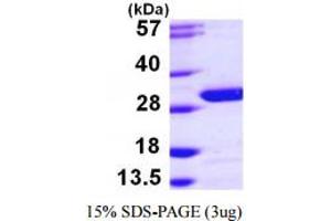 SDS-PAGE (SDS) image for Ubiquitin Carboxyl-terminal Esterase L3 (Ubiquitin Thiolesterase) (Uchl3) (AA 1-230) protein (His tag) (ABIN667324) (UCHL3 Protein (AA 1-230) (His tag))