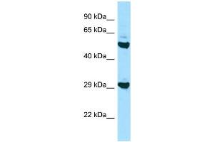 Western Blotting (WB) image for anti-Major Histocompatibility Complex, Class II, DO beta (HLA-DOB) (N-Term) antibody (ABIN2435823) (HLA-DOB 抗体  (N-Term))