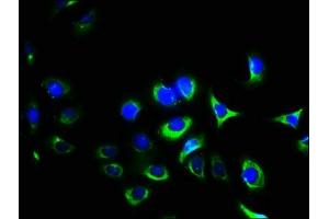 Immunofluorescence staining of A549 cells with ABIN7156456 at 1:400, counter-stained with DAPI. (Integrin Alpha2b 抗体  (AA 639-887))