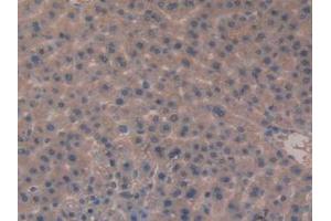 IHC-P analysis of Rat Liver Tissue, with DAB staining. (Meprin B 抗体  (AA 433-679))