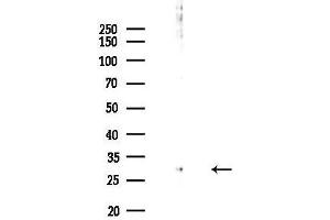 Western blot analysis of lysates from HepG2 cells(UV,30 min treatment), using RNF144A Antibody at 1/1000 dilution.
