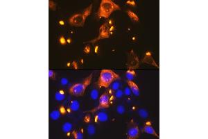 Immunofluorescence (IF) image for anti-Solute Carrier Family 2 (Facilitated Glucose Transporter), Member 2 (SLC2A2) antibody (ABIN7270414)