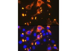 Immunofluorescence analysis of NIH-3T3 cells using GLUT2/SLC2 Rabbit mAb (ABIN7270414) at dilution of 1:100 (40x lens). (SLC2A2 抗体)