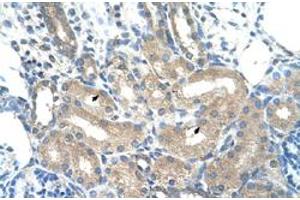 Immunohistochemical staining (Formalin-fixed paraffin-embedded sections) of human kidney with ADH1B polyclonal antibody  at 4-8 ug/mL working concentration.