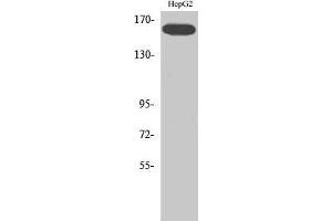 Western Blot (WB) analysis of specific cells using Phospho-Flk-1 (Y1214) Polyclonal Antibody. (VEGFR2/CD309 抗体  (pTyr1214))