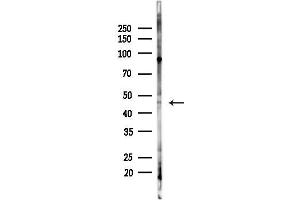 anti-S-Antigen, Retina and Pineal Gland (Arrestin) (SAG) (Internal Region) antibody