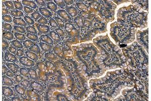 ABIN6263985 and ABIN6268931 at 1/100 staining Rat colon tissue by IHC-P.