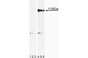 Western Blot analysis of Stat2 (pY690) in human histiocytic lymphoma. (STAT2 抗体  (pTyr690))