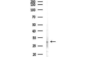 Western blot analysis of lysates from Hela cells(starvation,24h treatment), using Phospho-Cyclin  (Thr280) Antibody at 1/1000 dilution.