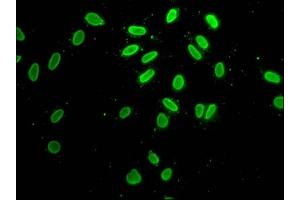 Immunofluorescence staining of Hela cells with ABIN7139193 at 1:25, counter-stained with DAPI. (H2AFZ 抗体  (acLys7))