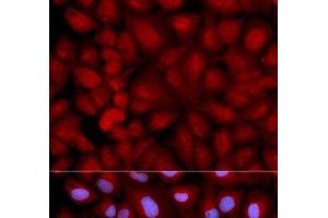 Immunofluorescence analysis of U2OS cells using SNCG Polyclonal Antibody (SNCG 抗体)