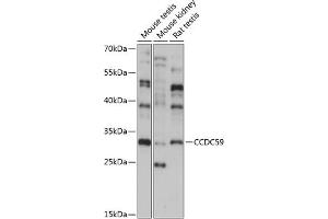 Western blot analysis of extracts of various cell lines, using CCDC59 antibody (ABIN7266440) at 1:1000 dilution. (CCDC59 抗体  (AA 1-241))