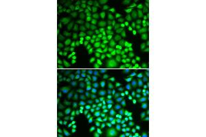 Immunofluorescence analysis of U2OS cells using PSMA4 antibody.
