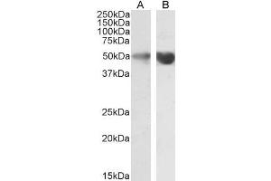 Western Blotting (WB) image for anti-Glial Fibrillary Acidic Protein (GFAP) (C-Term) antibody (ABIN185730)