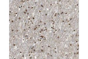 ABIN6266531 at 1/100 staining human brain tissue sections by IHC-P. (E2F4 抗体)