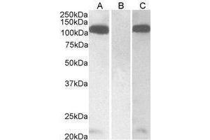 Western Blotting (WB) image for anti-Furin (Paired Basic Amino Acid Cleaving Enzyme) (FURIN) (C-Term) antibody (ABIN2473713) (FURIN 抗体  (C-Term))