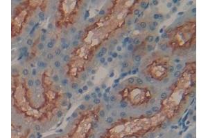 Detection of MEP1a in Human Kidney Tissue using Polyclonal Antibody to Meprin A Alpha (MEP1a) (MEP1A 抗体  (AA 213-506))