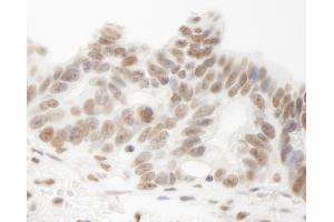 Immunohistochemistry (IHC) image for anti-Heterogeneous Nuclear Ribonucleoprotein U-Like 1 (HNRNPUL1) (AA 50-100) antibody (ABIN7448953)