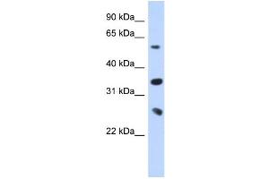 WB Suggested Anti-UBE2K Antibody Titration:  0. (UBE2K 抗体  (Middle Region))