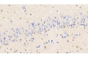 Immunohistochemistry (IHC) image for anti-Peroxiredoxin 6 (PRDX6) (AA 1-224) antibody (ABIN7443350)