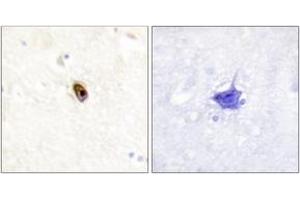 Immunohistochemistry analysis of paraffin-embedded human brain, using AurB/C (Phospho-Thr236/202) Antibody. (AurB/C 抗体  (pThr236))