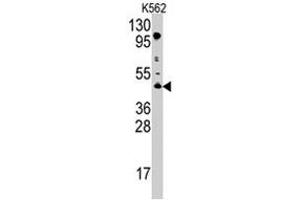 Western blot analysis of PRMT8 polyclonal antibody  in K-562 cell line lysates (35 ug/lane).
