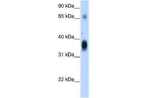 NOV antibody used at 1. (NOV 抗体  (Middle Region))