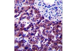 Immunohistochemistry (Paraffin-embedded Sections) (IHC (p)) image for anti-Olfactory Receptor, Family 14, Subfamily J, Member 1 (OR14J1) (AA 205-234), (C-Term) antibody (ABIN953830)