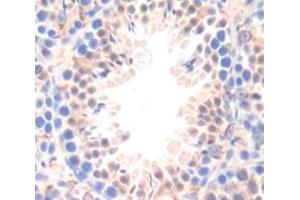 Immunohistochemistry (IHC) image for anti-Growth Arrest and DNA-Damage-Inducible, gamma (GADD45G) (AA 1-159) antibody (ABIN1868088)