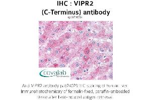 Image no. 1 for anti-Vasoactive Intestinal Peptide Receptor 2 (VIPR2) (C-Term) antibody (ABIN1740724)